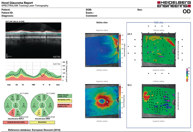 Glaucoma Module, Hood Glaucoma Report