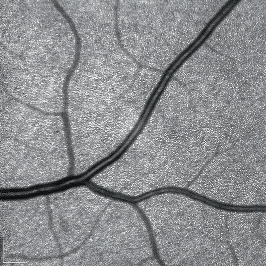 High Magnification, microestruturas retinianas