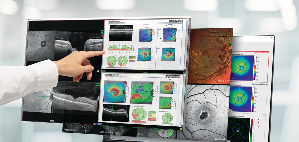 SPECTRALIS, plataforma multimodal com múltiplos módulos