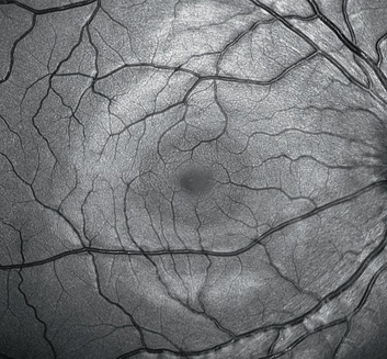 Widefield Imaging, campo de 55°