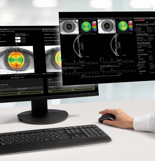 Interface ANTERION — planejamento de catarata em dois monitores