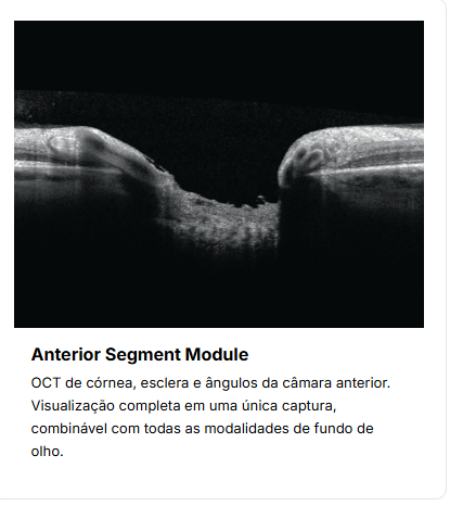 Anterior Segment Module — OCT de córnea e câmara anterior