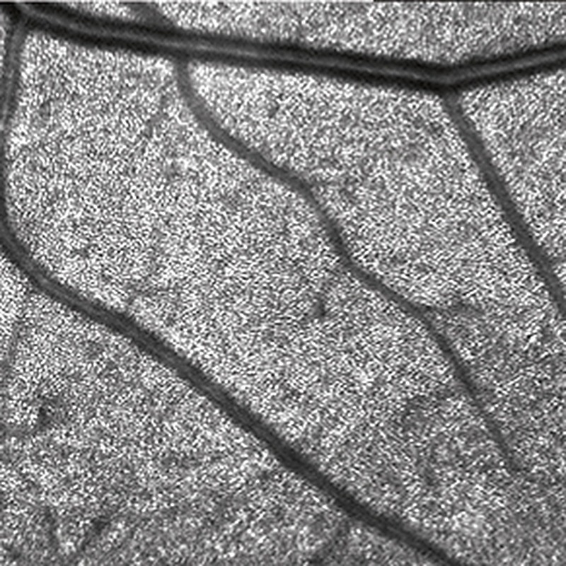 High Magnification, microestruturas retinianas
